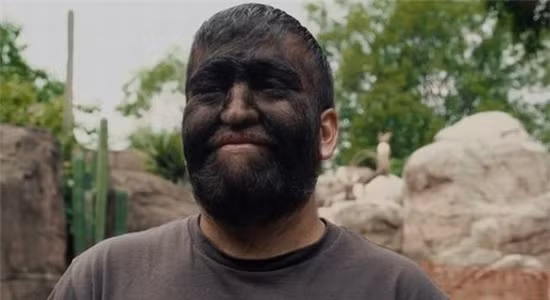 Những người sói có thật và cuộc đời đầy bi đát ảnh 8