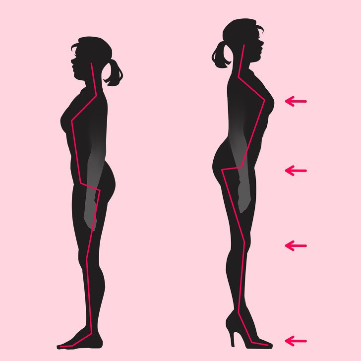 ngoai ban chan, 3 bo phan co the nay cung ton thuong vi giay cao got hinh 1