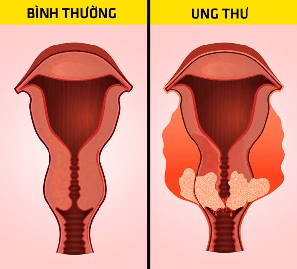 bung day hoi ai cung gap nhung can than no co the canh bao 6 benh nguy hiem chet nguoi - 6