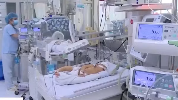 Loại virus khiến nhiều cha mẹ Việt hốt hoảng dễ dàng lây khi hôn trẻ