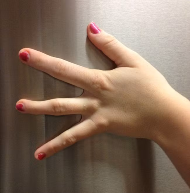 Những căn bệnh quái đản chỉ cần nghe tên đã thấy rùng mình - Ảnh 3.