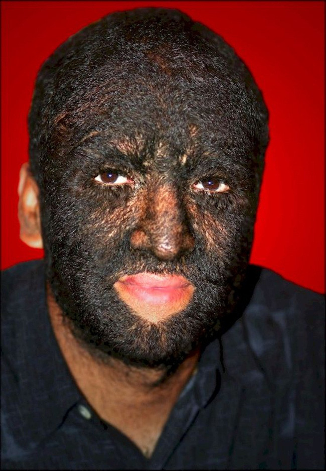 Những căn bệnh quái đản chỉ cần nghe tên đã thấy rùng mình - Ảnh 10.