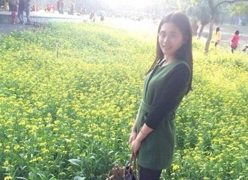 Cô gái trẻ biến thành bà lão chỉ sau một đêm ảnh 2 Cô gái trẻ biến thành bà lão chỉ sau một đêm - Hình 2