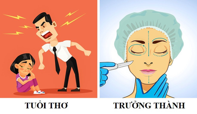 1. Không thể hiện tình yêu với con: Với trẻ em, bố mẹ là người quan trọng nhất. Nếu không cảm nhận được tình yêu từ cha mẹ, trẻ sẽ bị tổn thương, không yêu quý bản thân. Đây cũng là lý do nhiều người phẫu thuật thẩm mỹ để thay đổi ngoại hình. Nhưng ngược lại, nếu biểu hiện tình yêu thái quá đến mức kiểm soát gắt gao, cha mẹ lại khiến con trải qua tuổi thơ không hạnh phúc. 8 sai lam khi day con lam anh huong xau den tuong lai tre hinh anh 1