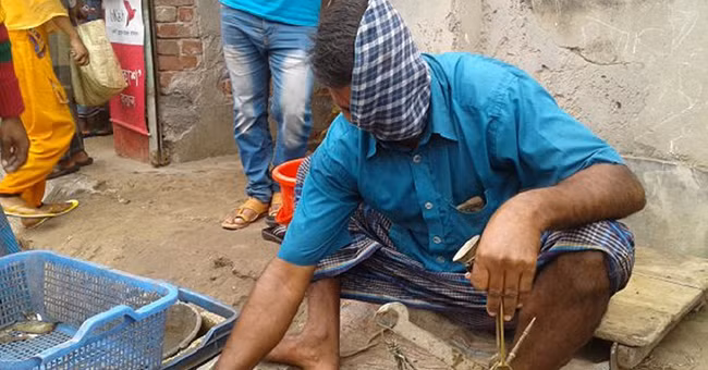 Răng môi, mắt mũi lẫn lộn do bị hổ quật nát mặt - Ảnh 2.