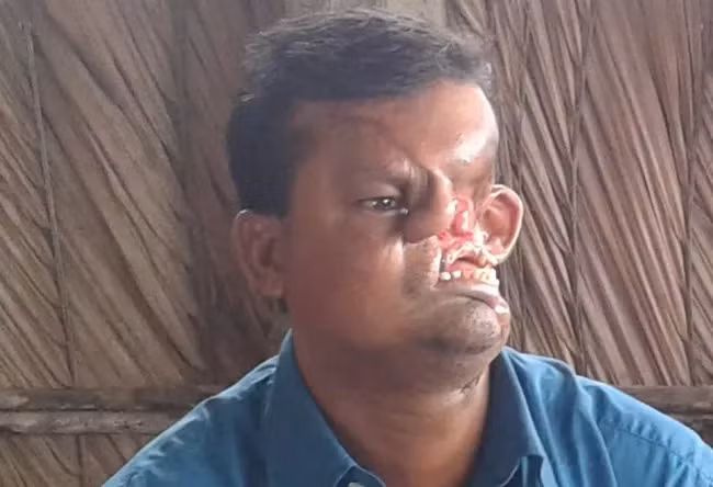 Răng môi, mắt mũi lẫn lộn do bị hổ quật nát mặt