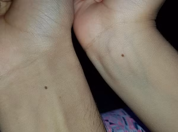 21 hình ảnh kỳ quặc ngẫu nhiên khiến bạn giật mình, thứ bệnh lạ khiến da không bao giờ có nếp nhăn - Hình 8