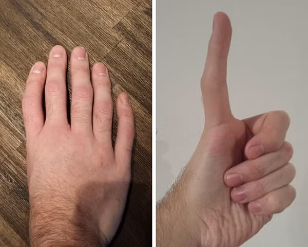 21 hình ảnh kỳ quặc ngẫu nhiên khiến bạn giật mình, thứ bệnh lạ khiến da không bao giờ có nếp nhăn - Hình 14