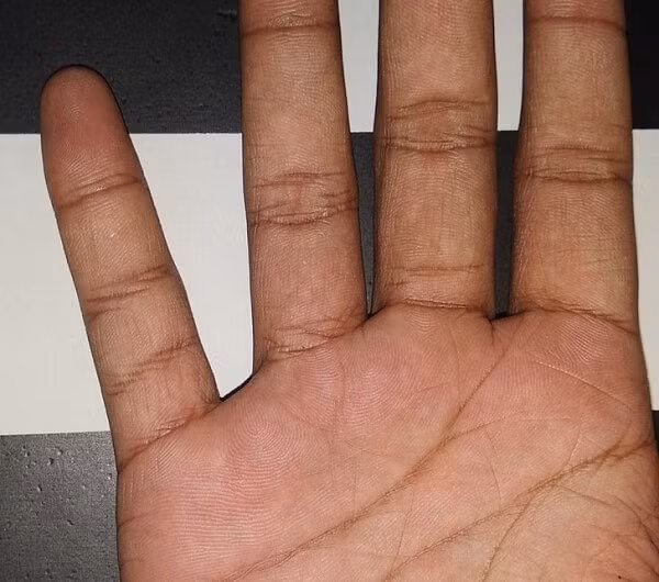 21 hình ảnh kỳ quặc ngẫu nhiên khiến bạn giật mình, thứ bệnh lạ khiến da không bao giờ có nếp nhăn - Hình 12