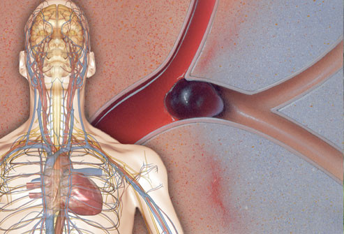 6 dấu hiệu sức khỏe không thể coi thường