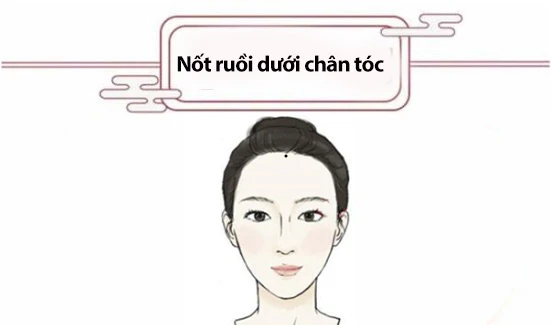 Phụ nữ có nốt ruồi sau đích thị là con cưng của Thần Tài, ngoài 40 tuổi phú quý thăng hoa