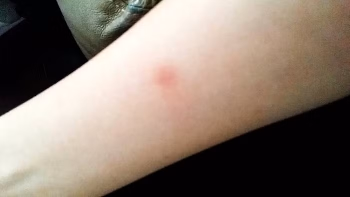 Cơ thể xuất hiện 3 triệu chứng này chứng tỏ gan đang bị tổn thương