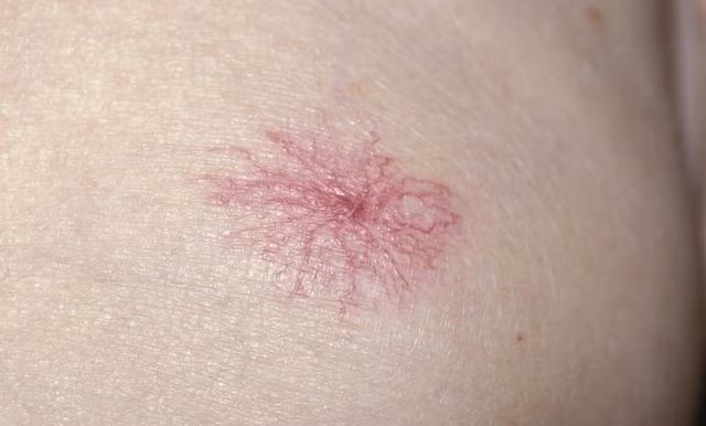 Cơ thể xuất hiện 3 triệu chứng này chứng tỏ gan đang bị tổn thương