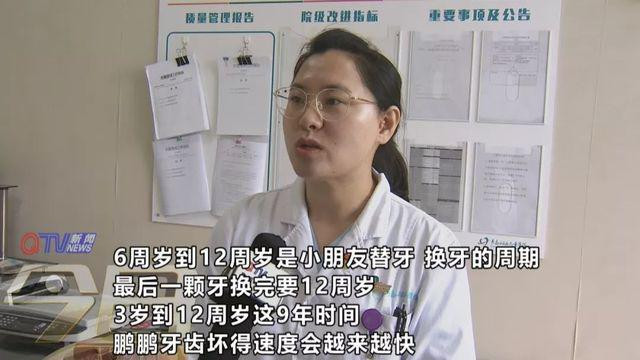 cau be 3 tuoi co toi 16 chiec rang bi mun nat, do thoi quen rat nhieu tre mac phai - 2