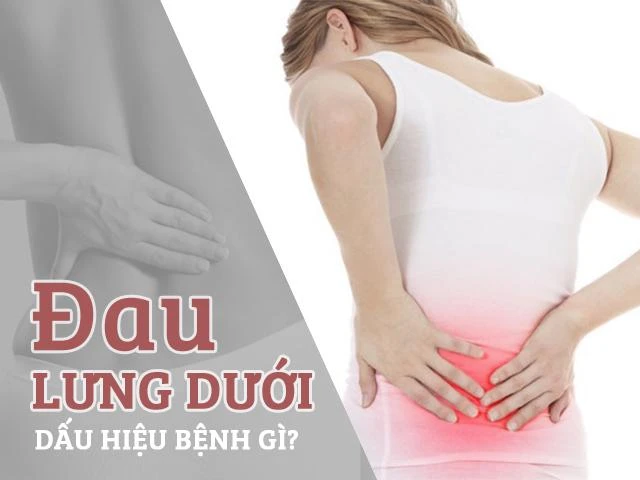 Đau lưng dưới và những chỉ báo nguy hiểm cho sức khỏe