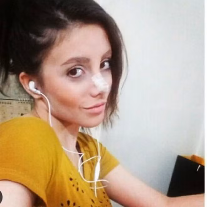 Cô gái phẫu thuật thẩm mỹ hơn 50 lần để nhìn giống Angelina Jolie, kết quả trả về gia tinh Dobby - Ảnh 7.