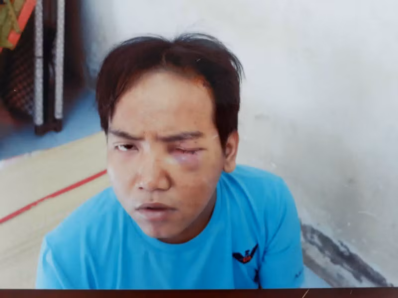  Nghi can Giang trong vụ bảo vệ dân phố vung dao lam sát hại bé 6 tuổi giữa phố.