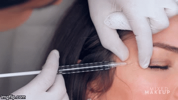 “Dắt túi” 4 phương pháp trị nếp nhăn sau thì dù tuổi tác có ập đến, các nàng cũng không phải lo nghĩ nhiều - Ảnh 4.