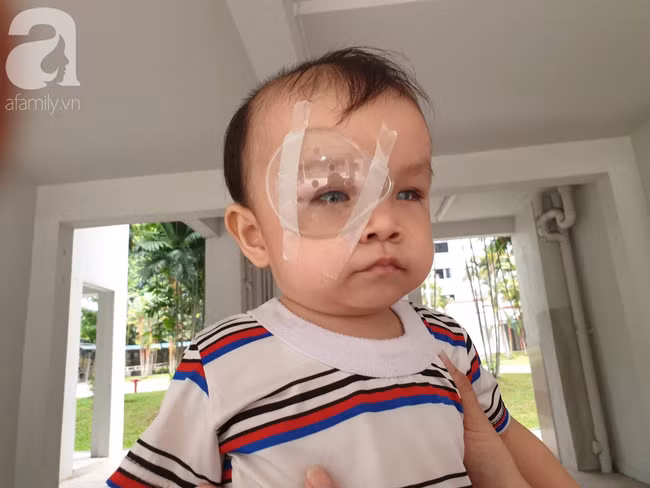 Bé trai 15 tháng tuổi có nguy cơ mù vĩnh viễn, người mẹ trẻ khóc cạn nước mắt đi tìm ánh sáng cho con - Ảnh 17.
