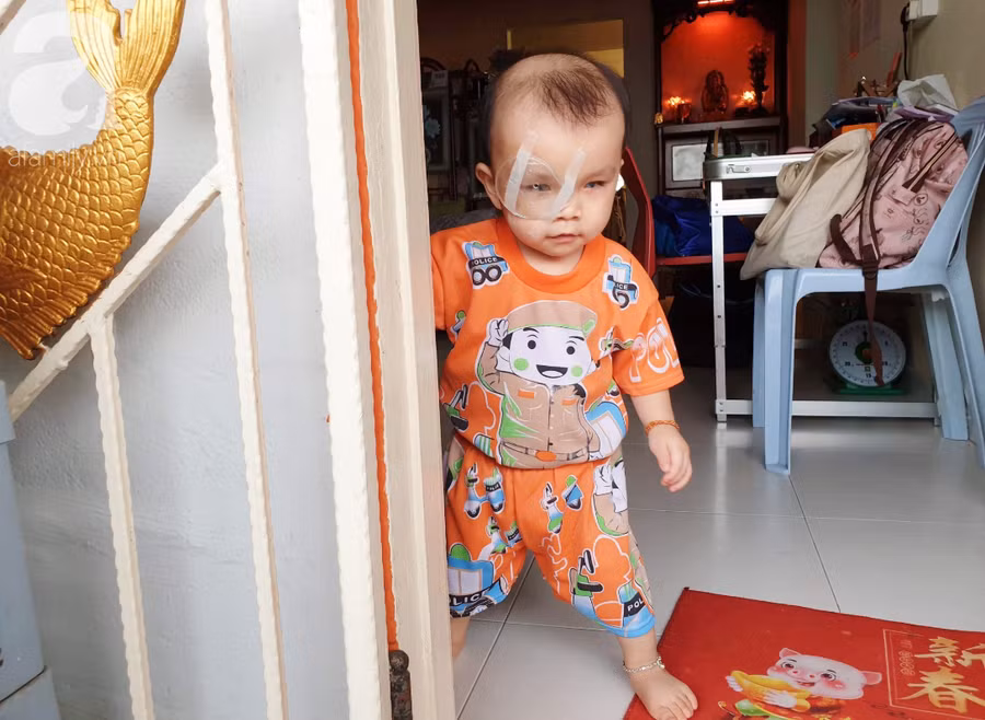 Bé trai 15 tháng tuổi có nguy cơ mù vĩnh viễn, người mẹ trẻ khóc cạn nước mắt đi tìm ánh sáng cho con - Ảnh 1.