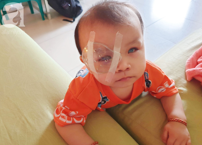 Bé trai 15 tháng tuổi có nguy cơ mù vĩnh viễn, người mẹ trẻ khóc cạn nước mắt đi tìm ánh sáng cho con - Ảnh 16. Bé trai 15 tháng tuổi có nguy cơ mù vĩnh viễn, người mẹ trẻ khóc cạn nước mắt đi tìm ánh sáng cho con - Ảnh 16.
