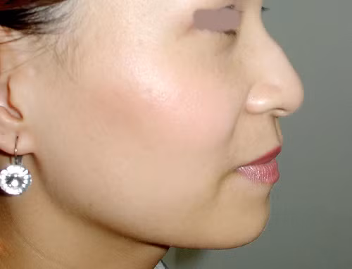 Phụ nữ sở hữu 1 trong 3 nét tướng này, xinh đẹp đến đâu cũng dễ lận đận tình duyên ảnh 2