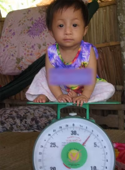 Cô bé tí hon ở Vĩnh Long giờ đã thành thiếu nữ… bé tí! - Ảnh 1.