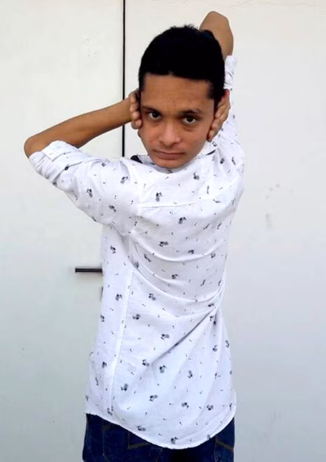 Choáng với chàng trai xoay được khớp vai 360 độ, xoay đầu ngược ra sau 180 độ ảnh 3