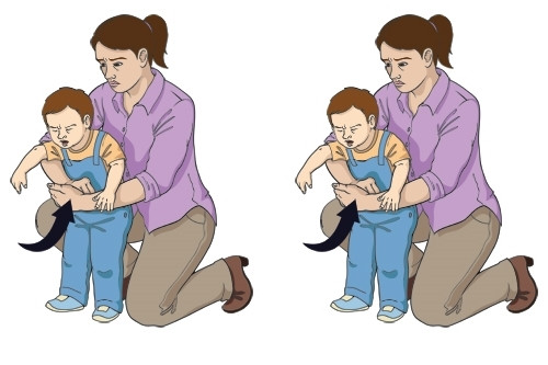 Cách sơ cứu khi con bị hóc hạt mận, hạt vải - Hình 2