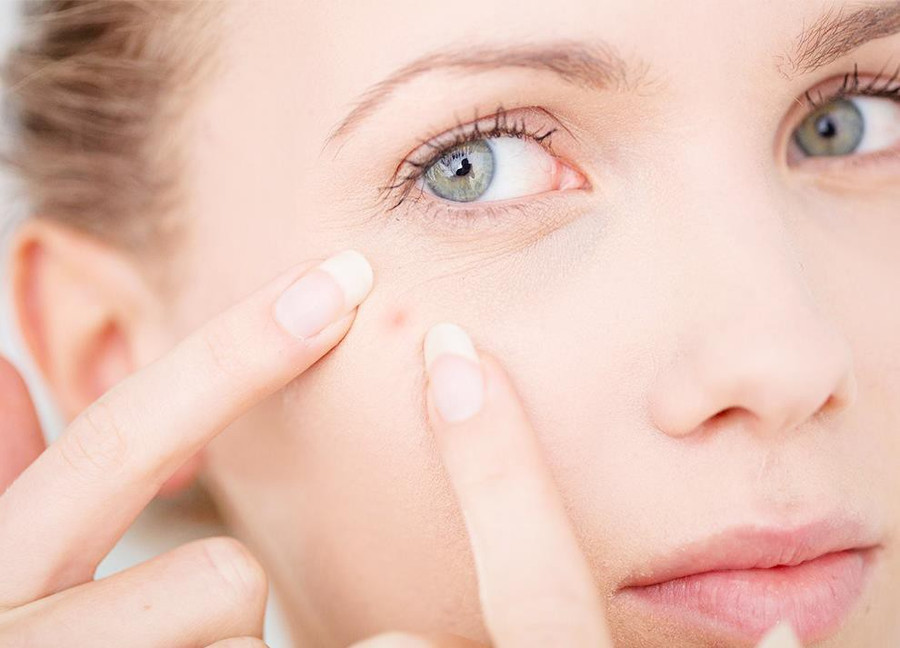 Bổ sung vào skincare routine những loại kem dưỡng chứa retinol, BHA, tinh dầu tràm trà (tea tree oil) với nồng độ phù hợp để góp phần hạn chế sự phát triển của mụn. Ảnh: laroche-posay.