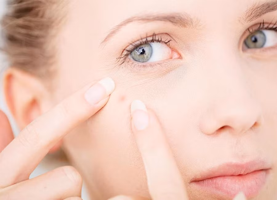 Bổ sung vào skincare routine những loại kem dưỡng chứa retinol, BHA, tinh dầu tràm trà (tea tree oil) với nồng độ phù hợp để góp phần hạn chế sự phát triển của mụn. Ảnh: laroche-posay.