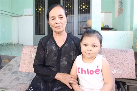 Những con người "trẻ mãi không già" vì bệnh lạ 