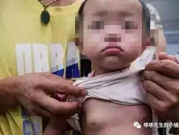 Bé gái 2 tuổi đã phát triển ngực vì bà thường xuyên cho uống loại nước không nên uống - 1
