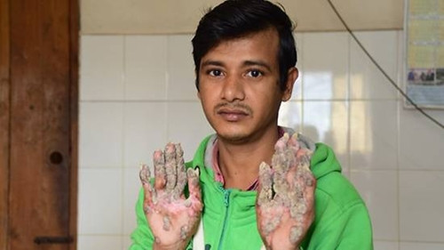 Bajanda hồi tháng 1/2018. Ảnh: AFP. Bajanda hồi tháng 1/2018. Ảnh: AFP.