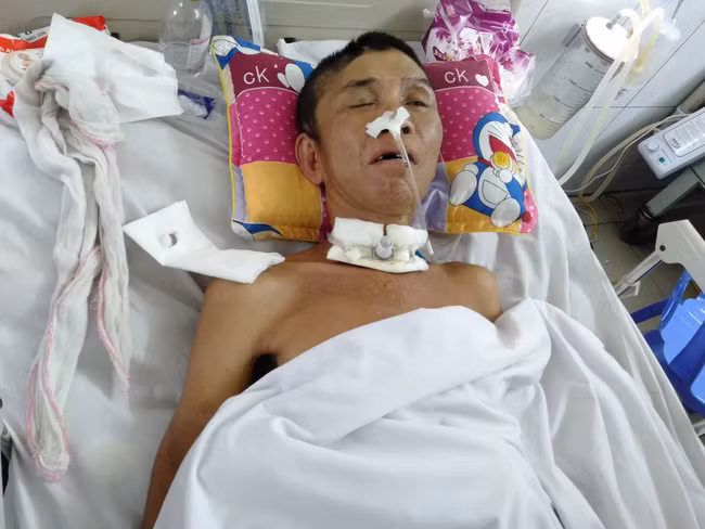 Bé trai 2 tuổi sợ hãi, khóc thét sau 2 tháng gặp lại bố bị tai nạn giao thông - Ảnh 3.