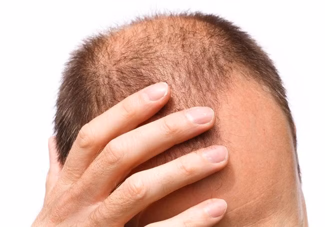 8-dau-hieu-co-the-canh-bao-som-mot-thang-truoc-con-dau-tim-4