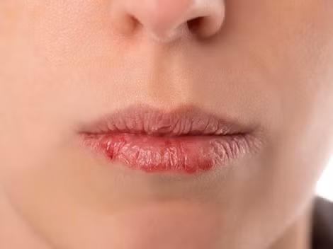 Có 5 nét tướng này trên khuôn mặt, dù bạn xinh đẹp nhưng vẫn ế như thường ảnh 6 Có 5 nét tướng này trên khuôn mặt, dù bạn xinh đẹp nhưng vẫn ế như thường ảnh 6