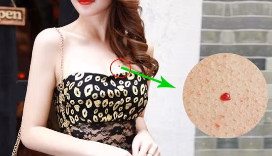 ai-co-not-ruoi-son-o-nhung-vi-tri-nay-thi-chi-viec-ngoi-ung-dung-de-huong-sung-suong-suot-cuoc-doi3-2018-08-17-13-37