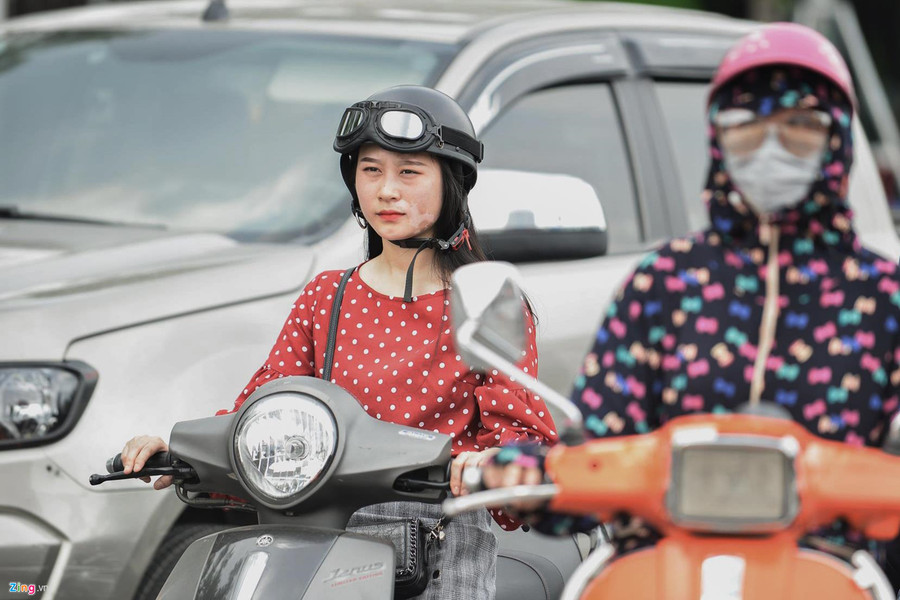 Mơ ước thầm kín của cô gái 20 năm với vết bạch biến trên mặt ảnh 9 Co gai xinh dep bi huy hoai khuon mat vi can benh chua co thuoc chua hinh anh 13