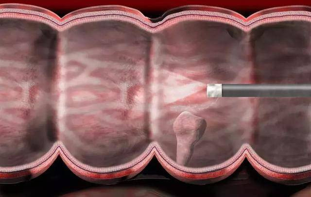 Cơ thể xuất hiện màu đen ở 3 bộ phận này, bạn có thể đã mắc bệnh ung thư - Ảnh 2 Cơ thể xuất hiện màu đen ở 3 bộ phận này, bạn có thể đã mắc bệnh ung thư - Ảnh 2