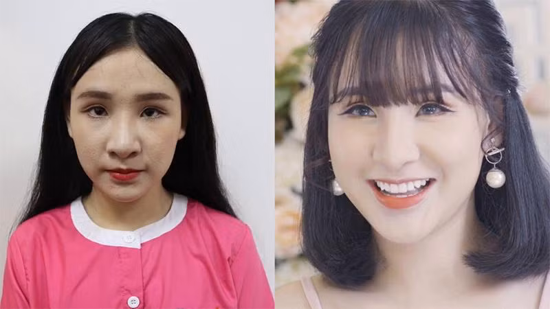 Trước khi phẫu thuật thẩm mỹ, cần biết những điều này để tránh trở thành thảm họa