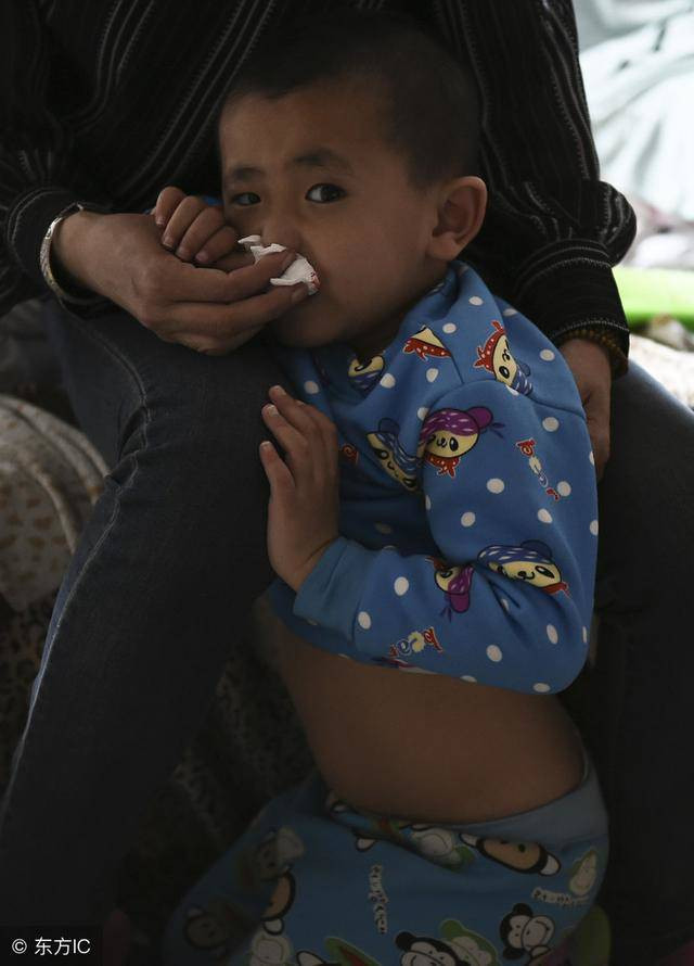 be 3 tuoi mat mang vi cach so cuu chay mau cam pho bien cua nhieu ba me - 3