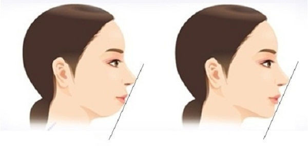 Xem tướng cằm đoán ngay tính cách, số giàu sang hay nghèo hèn