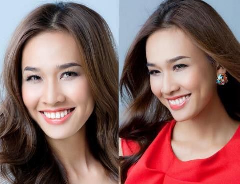 Tự tạo má lúm đồng tiền khiến vạn người mê...
