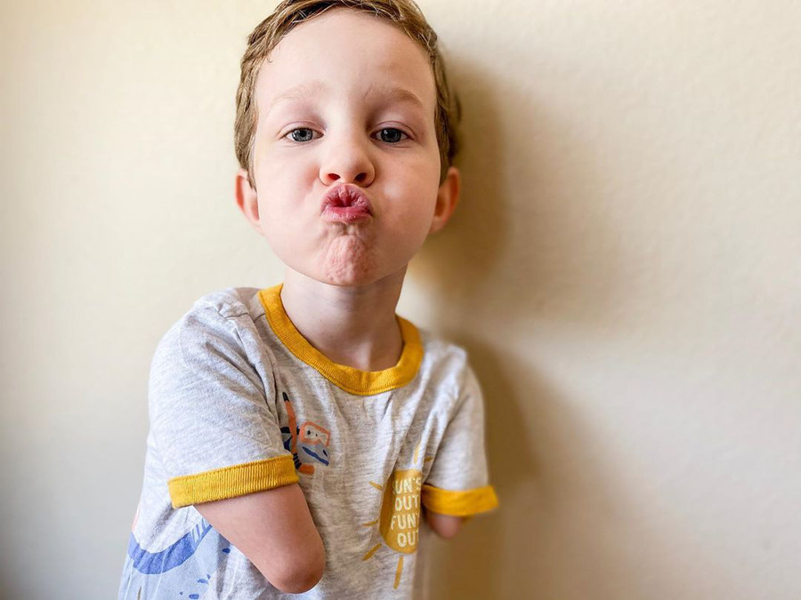 Sinh ra không tay, không chân cậu bé vẫn làm được điều phi thường khiến nhiều người rơi nước mắt ảnh 6 Sinh ra không tay, không chân cậu bé vẫn làm được điều phi thường khiến nhiều người rơi nước mắt ảnh 6