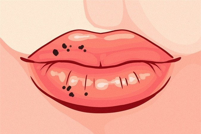 8 điều mà đôi môi đang hé lộ sức khỏe có vấn đề mà bạn mảy may không biết