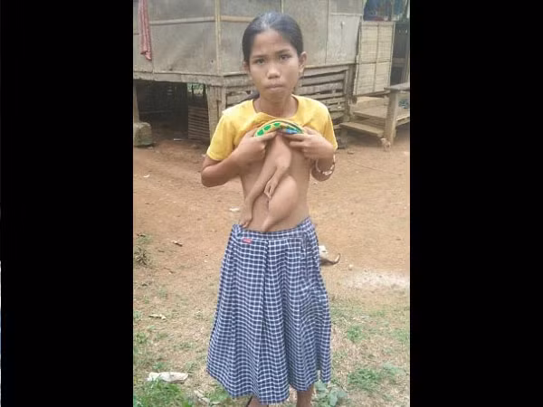 hoang hon khi thay co gai tre moc tay va chan tren bung hinh anh 2