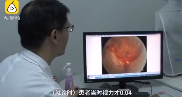 Bác sĩ đã tiến hành phẫu thuật laser cho nam bệnh nhân.