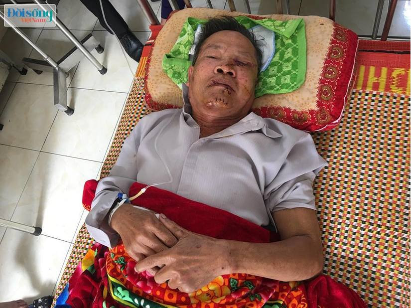 loi ke hai hung nan nhan vu dot nhap, sat hai nu gia chu o hung yen hinh anh 3