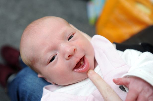 Con vừa mới sinh ra đời mẹ đã choáng váng không tin được khi thấy vật thể lạ lùng này trong miệng con - Ảnh 3. Con vừa mới sinh ra đời mẹ đã choáng váng không tin được khi thấy vật thể lạ lùng này trong miệng con - Ảnh 3.